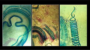 Photographs showing xylem elements in the shoot of a fig tree (Ficus alba): crushed in hydrochloric acid, between slides and cover slips.